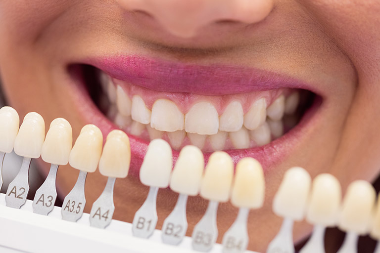 Paciente eligiendo coronas para implantes dentales tras asegurarse de su elegibilidad