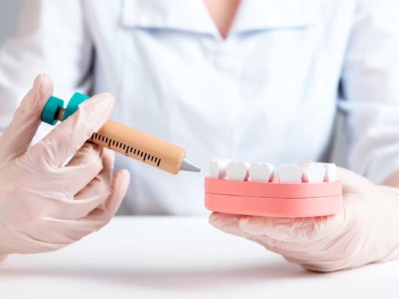 6 Cosas que debes saber sobre la anestesia dental