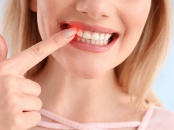 El cuidado de las encías en las mujeres - Clínica Dental Zoco Rizas - Dentista en Rivas-Vaciamadrid