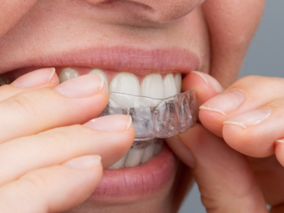 Clínica Zoco Rivas. Evita los riesgos de la ortodoncia invisible por internet